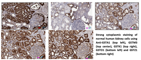 IHC of GSTs in Human Kidney